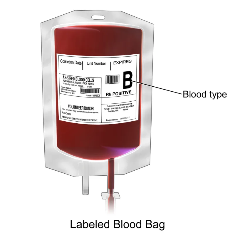 A medical illustration of a blood bag and the line running from it