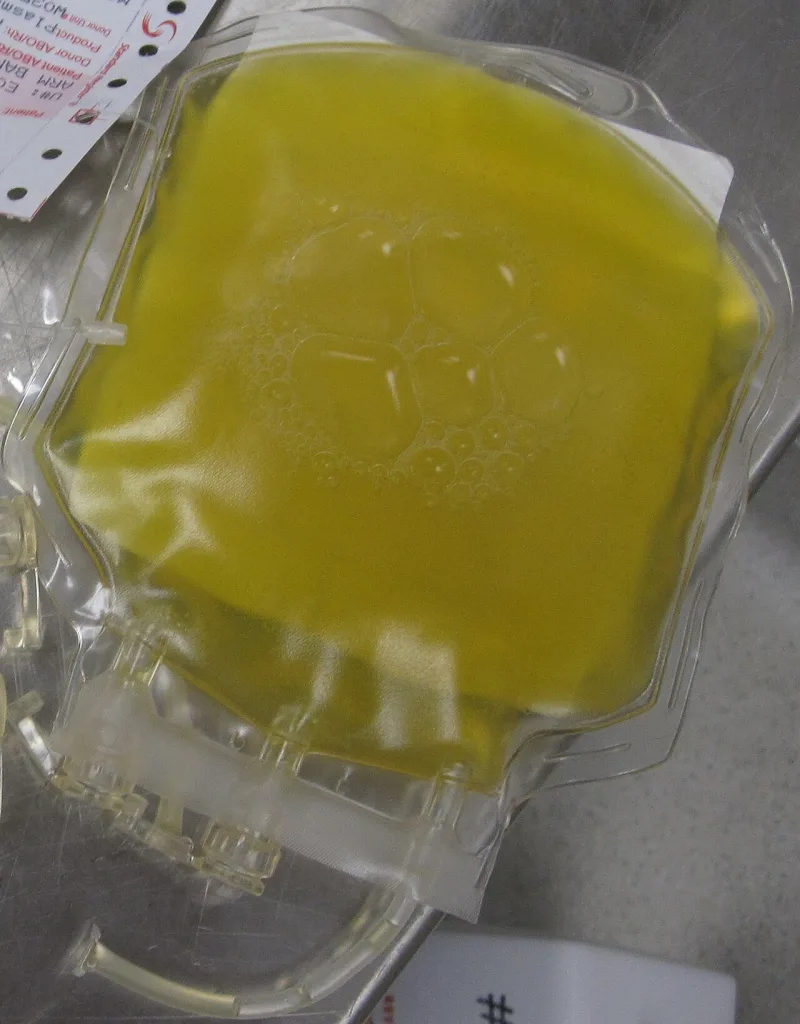 One unit of fresh frozen plasma, one of the four primary components the policy forbids