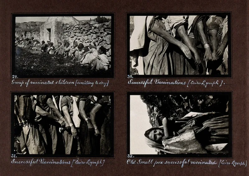 Children after smallpox vaccination in a 1920s epidemic; a representative image of campaigns then running