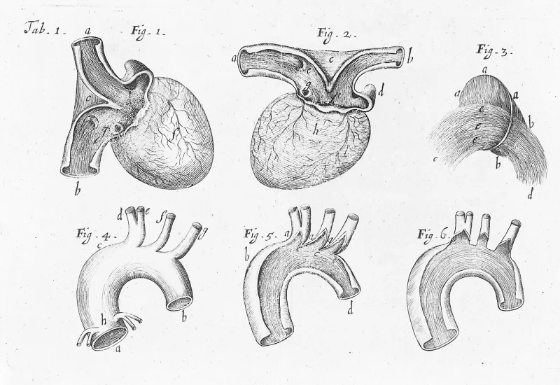 An anatomical plate of the heart and aorta from the Wellcome Collection